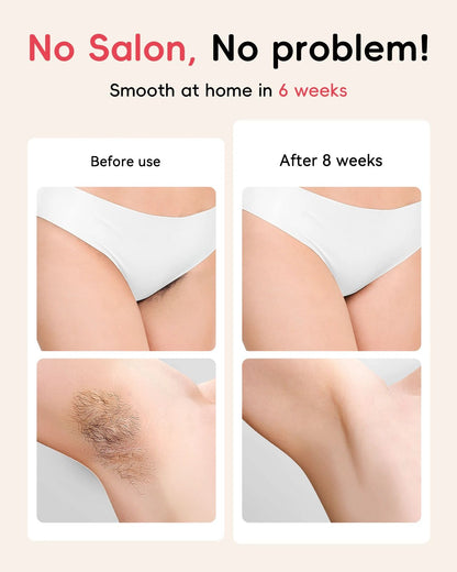 Hair Removal Laser With Unlimited IGBT  Fast Flashes Painless Body Epilator For Bikini Armpit  Face 2
