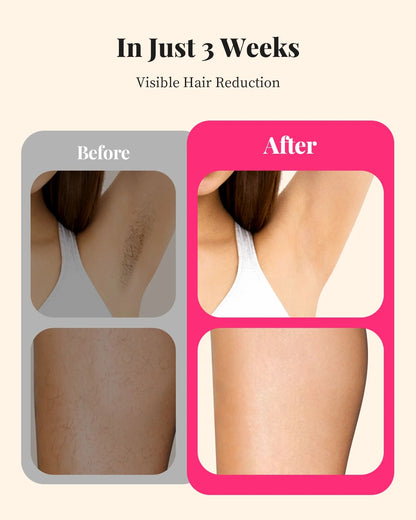 Flashes IPL Laser Hair Removal Device Painless Permanent Hair Removal For Women And Men Full Body B 5