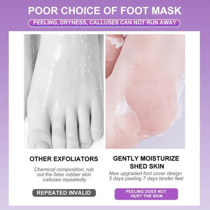 Exfoliating Foot Peel Mask For Baby Soft Feet Callus Remover Socks To Remove Dead Skin  Cracked Hee 2