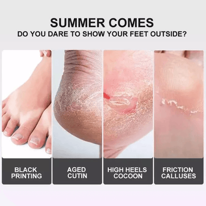 Exfoliating Foot Peel Mask For Baby Soft Feet Callus Remover Socks To Remove Dead Skin  Cracked Hee 4