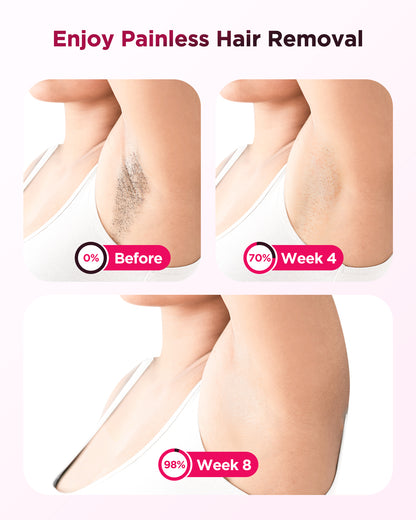 At Home IPL Hair Removal Machine 990K Flashes For Full Body Use Painless  Clinically Effective Unde 5