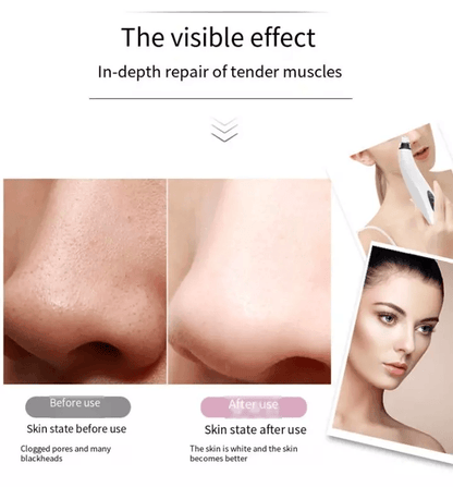 Electric Blackhead Remover Cleaner Face Diamond Pore Vacuum With Whitehead Suction Tool 2