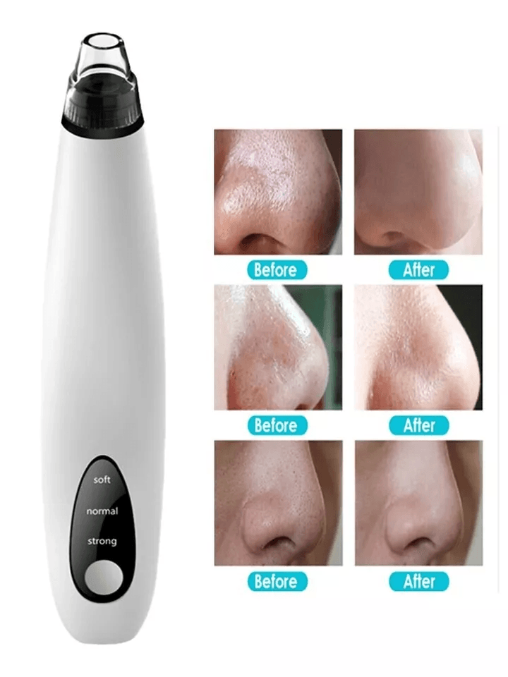 Electric Blackhead Remover Cleaner Face Diamond Pore Vacuum With Whitehead Suction Tool 3