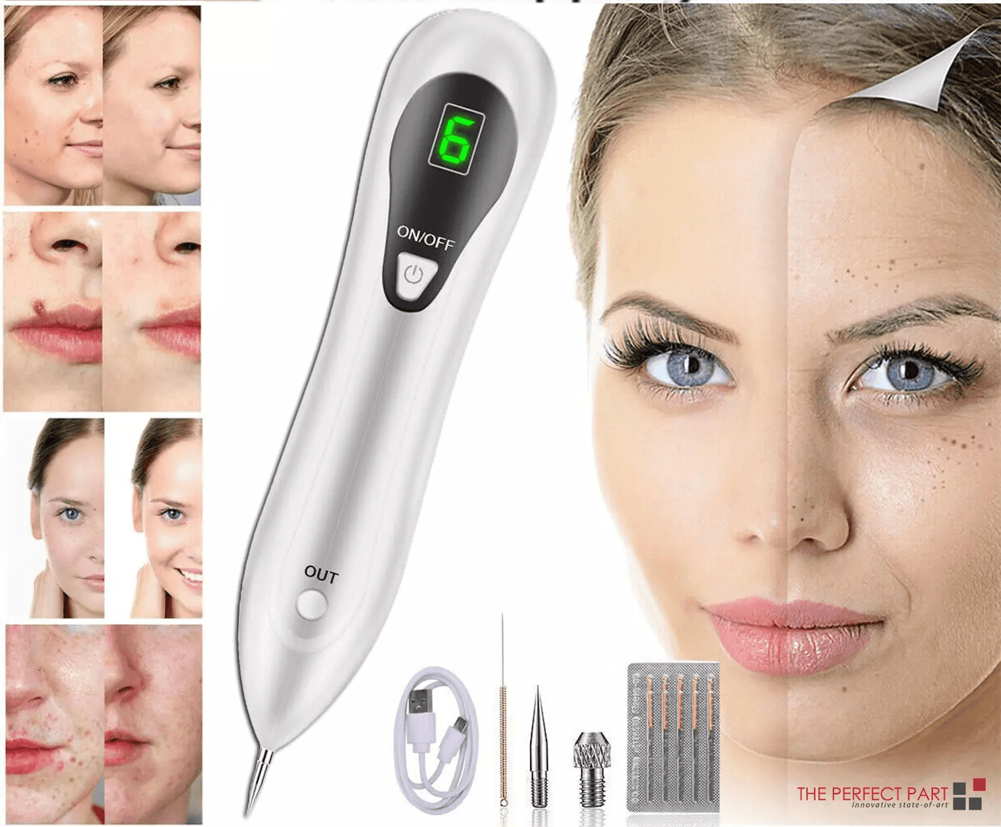 Professional Electric Laser Plasma Pen, Dark Spot Remover, Mole & Skin Tag Removal Tool, Wart & Tattoo Cleaner Skincare