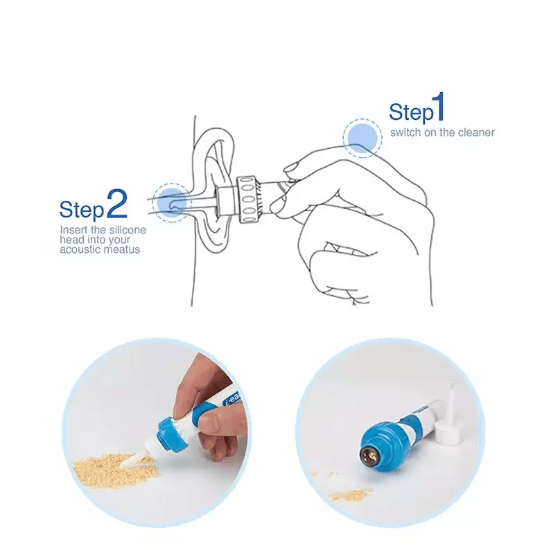 Electric Cordless Vacuum Ear Cleaner Wax Remover  Safe  Painless Ear Wax Removal Tool With Soft Tip 5