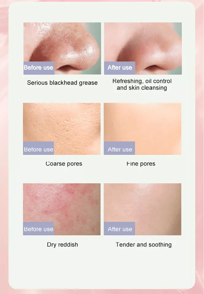 Purifying Green Tea Clay Mask Stick Deep Cleansing Blackhead Remover  Acne Treatment For All Skin T 2