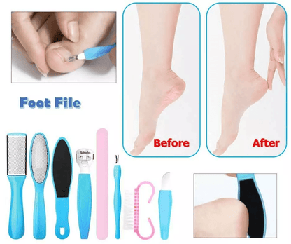 Professional Pedicure Kit Callus Remover Foot File Scraper Brush  Nail Rasp 1