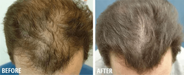 Best Hair Loss Conditioner For Men Women DAROXIL Fast Regrowth Therapy With 16 Organic Oils DHT Blo 2