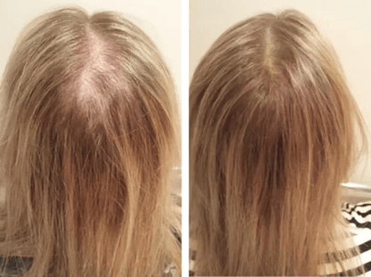 Best Hair Loss Conditioner For Men Women DAROXIL Fast Regrowth Therapy With 16 Organic Oils DHT Blo 3