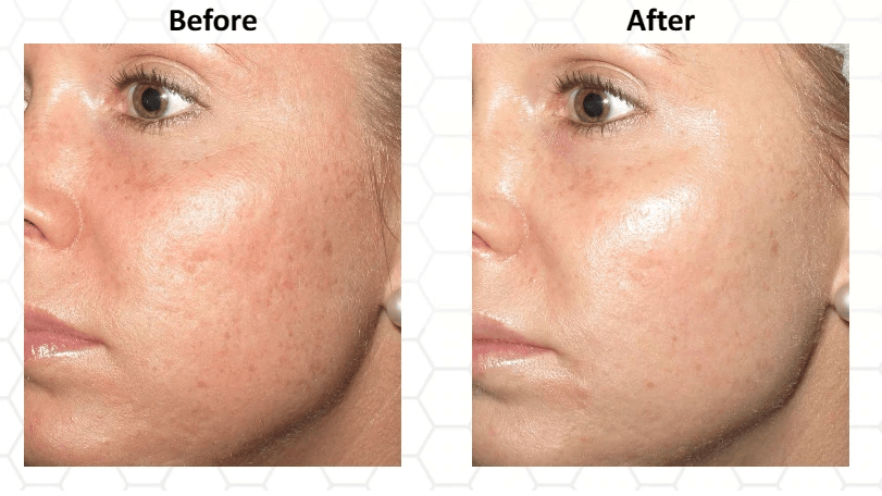 Vitamin C 30 Facial Serum With Hyaluronic Acid Ferulic Acid AntiAging Gel Cream For Brightening Fir 6