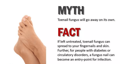 Natural Nail Fungus Treatment Effective Solution For Toe  Finger Nail Infections 2