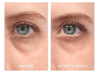TURN BACK THE CLOCK AntiAging Facial Serum Retinol Vitamin A Cream 2