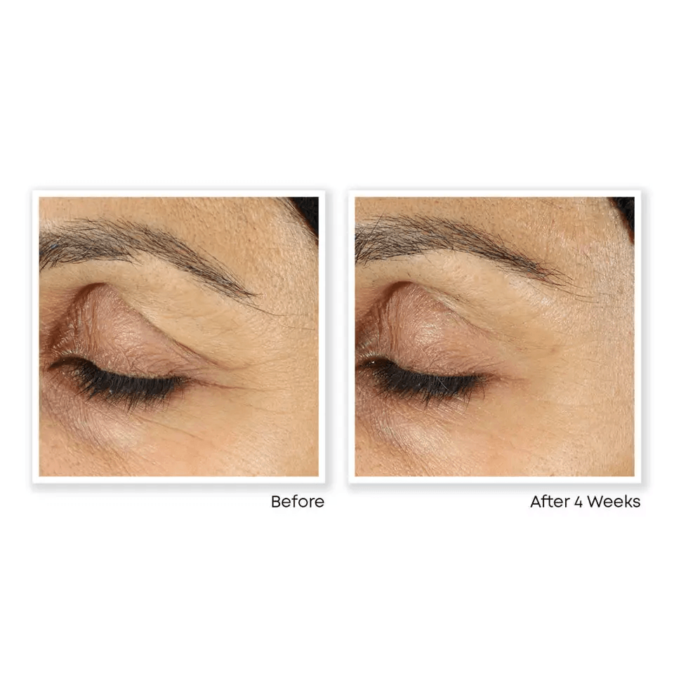 TURN BACK THE CLOCK AntiAging Facial Serum Retinol Vitamin A Cream 3