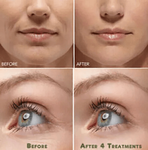 Pure Hyaluronic Acid Serum Anti Aging Hydration For Wrinkle  Fine Line Reduction 2