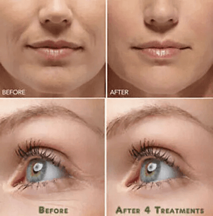 Pure Hyaluronic Acid Serum Anti Aging Hydration For Wrinkle  Fine Line Reduction 2