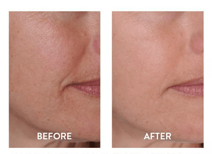 Pure Hyaluronic Acid Serum Anti Aging Hydration For Wrinkle  Fine Line Reduction 3