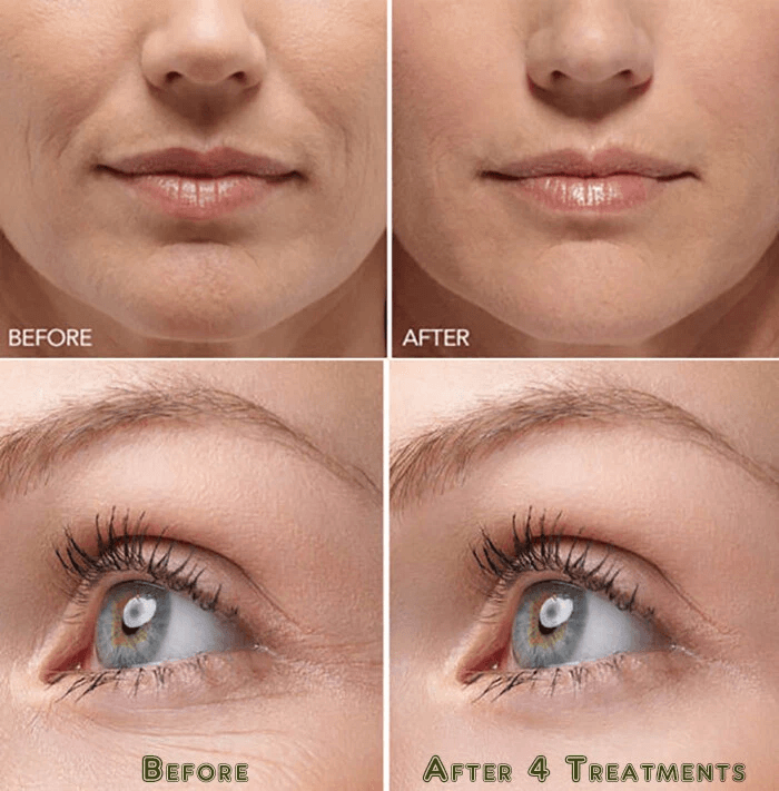 Hyaluronic Acid Gel Cream AntiAging Face Eye Moisturizer With NextGen HA Serum For Wrinkle Fine Lin 4