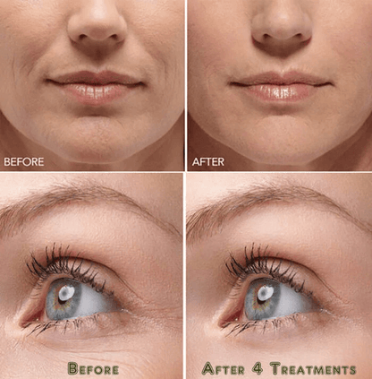 Hyaluronic Acid Gel Cream AntiAging Face Eye Moisturizer With NextGen HA Serum For Wrinkle Fine Lin 4