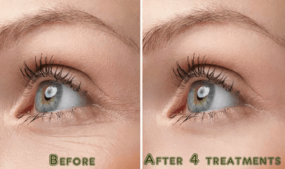 Hyaluronic Acid Serum AntiAging Wrinkle Rejuvenating Hydrator With Peptides Vitamins For Face Eyes  4