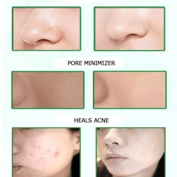 Dead Sea Mud Mask  Acne Face Cleanser Blackhead Remover  Healing Clay For Muscle Joint Pain Relief 1