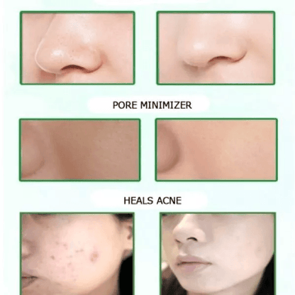 Dead Sea Mud Mask  Acne Face Cleanser Blackhead Remover  Healing Clay For Muscle Joint Pain Relief 1
