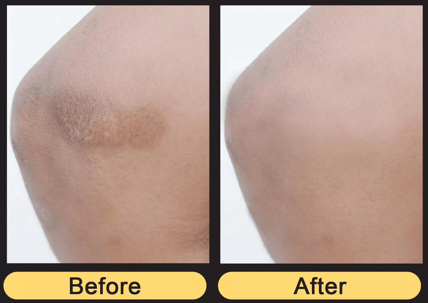 Vitamin K Cream Maximum Strength Skin Repair Spider Vein Varicose Vein Bruise Treatment For All Ski 1