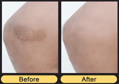 Vitamin K Cream Maximum Strength Skin Repair Spider Vein Varicose Vein Bruise Treatment For All Ski 1