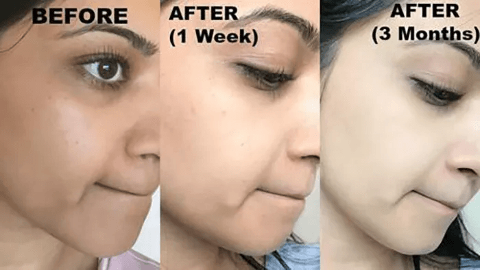 KOJIC ACID Skin Whitening Face Brightening Serum Dark Spot Remover With Alpha ArbutinVitamin C Mela 2
