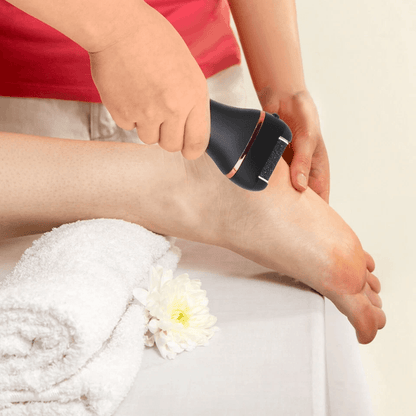 Electric Foot Grinder File Callus  Dead Skin Remover Pedicure Tool Rechargeable Kit For Smooth Feet 5