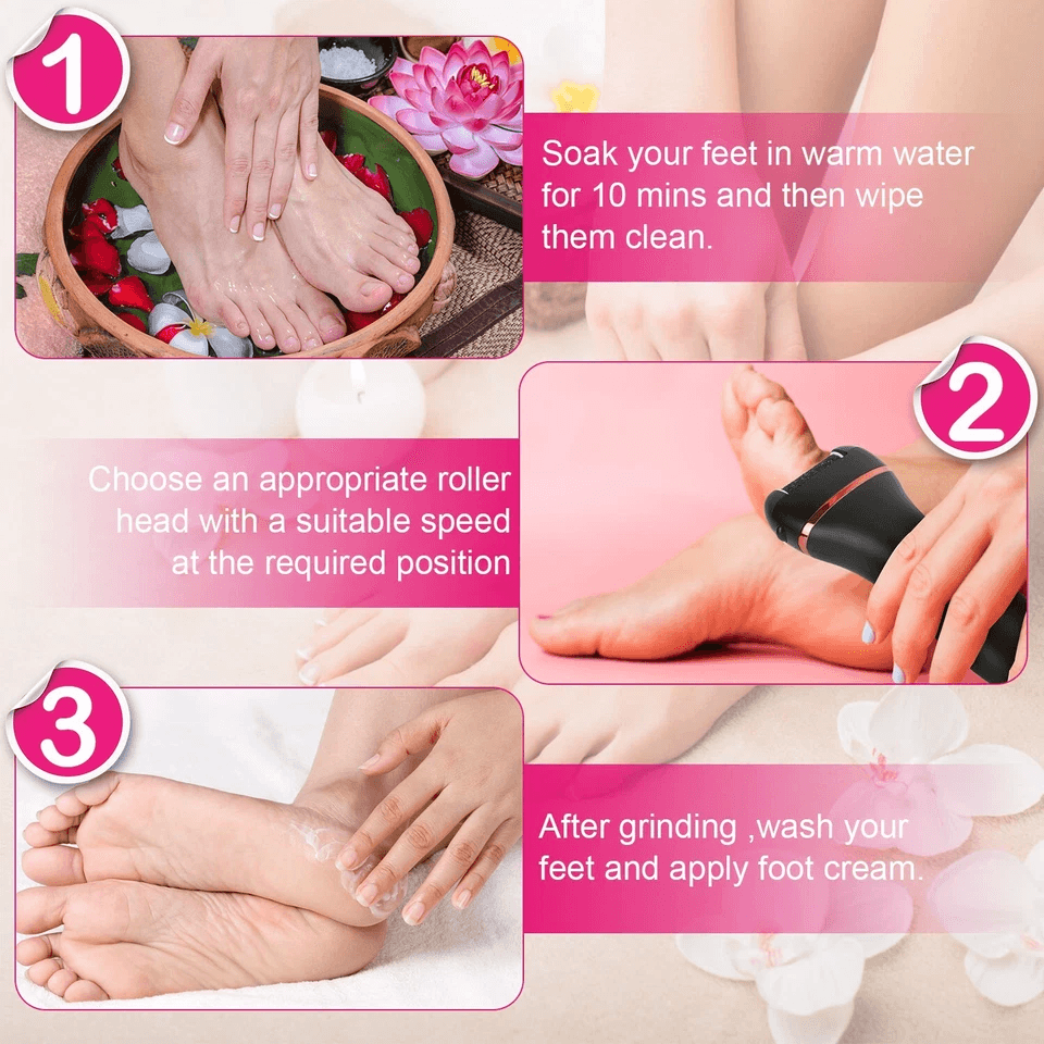 Electric Foot Grinder File Callus  Dead Skin Remover Pedicure Tool Rechargeable Kit For Smooth Feet 2