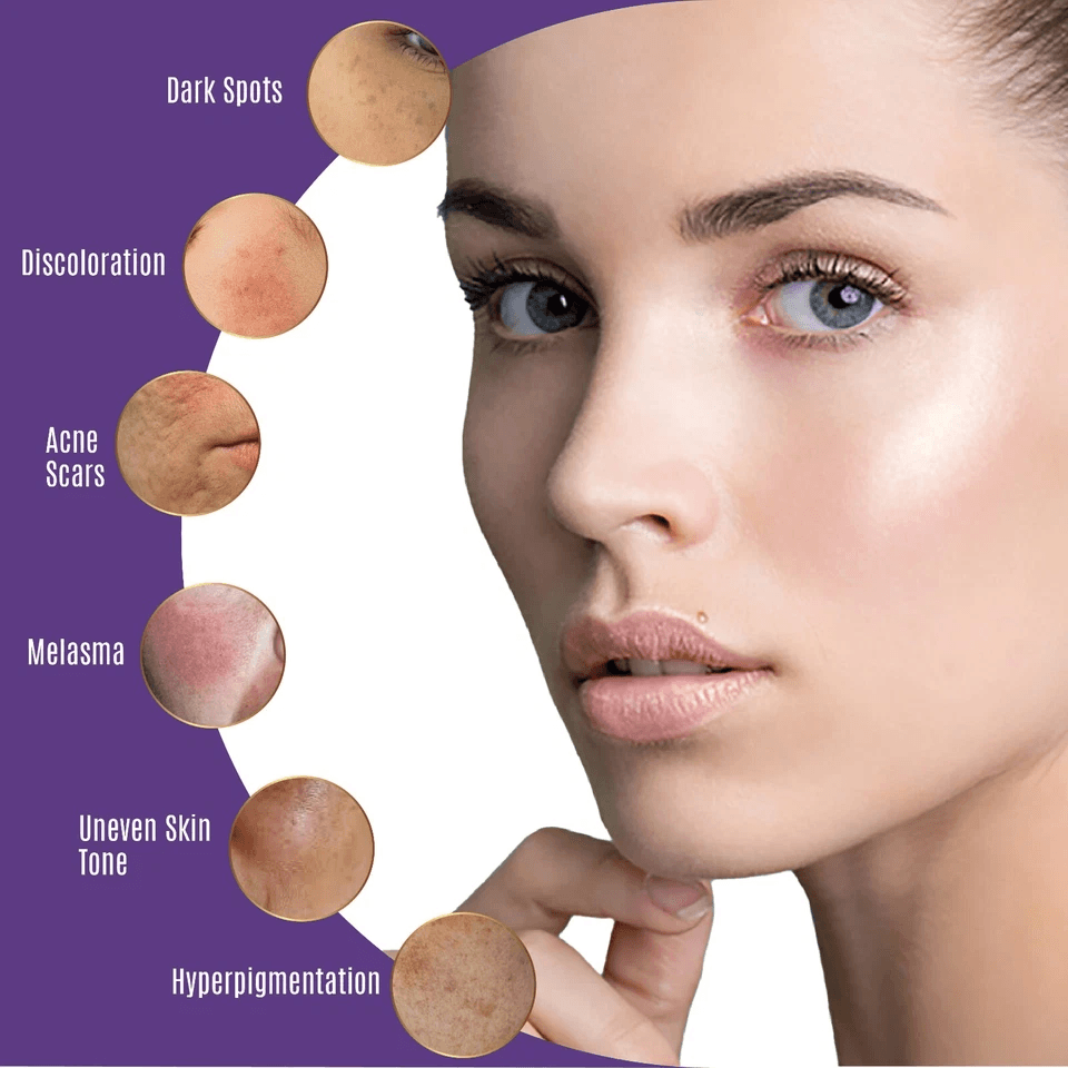Organic Dark Spot Corrector For Face  Body Age Spot  Sunspot Remover Serum 4