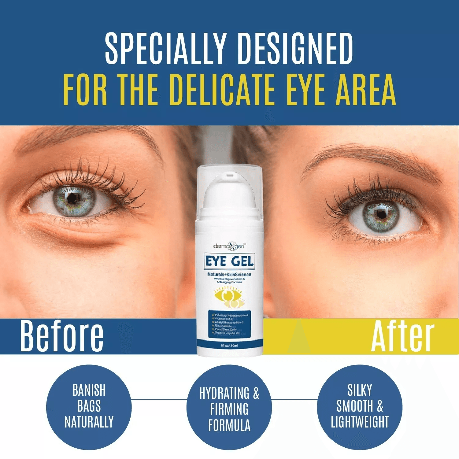 Anti-Aging Eye Gel by Dermaxgen, Eye Bag Remover for Dark Circles, Crows Feet, Wrinkles, Lift & Firm Formula with Stem