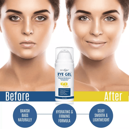 AntiAging Eye Gel By Dermaxgen Eye Bag Remover For Dark Circles Crows Feet Wrinkles Lift  Firm Form 4