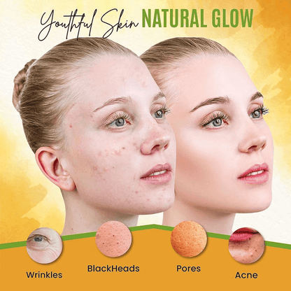 Dermaxgen Turmeric Face Mask With Vitamin C Lactic Acid  Dark Spot Corrector For Glowing Skin 3