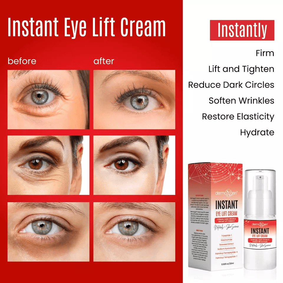Instant Eye Bag Remover 20ml AntiAging Cream For Dark Circles Crow Feet  Puffiness 4
