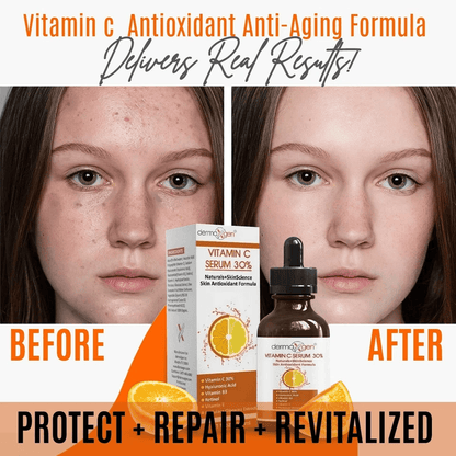 AntiAging Dermaxgen Vitamin C Serum With Retinol  Hyaluronic Acid PURE ORGANIC Face Moisturizer For