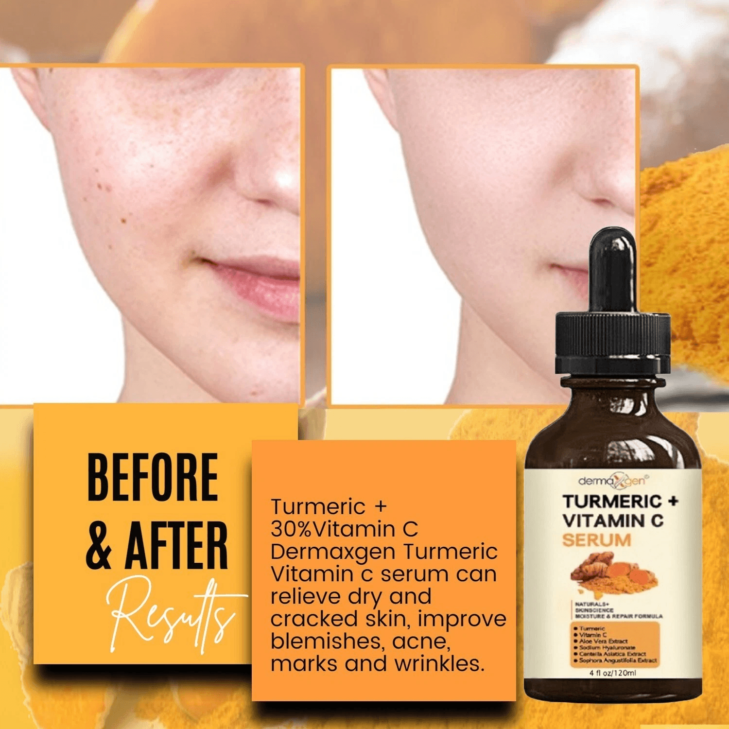 Organic Turmeric Face Serum Dermaxgen Skin Brightening Formula With Pure Vitamin C  Hyaluronic Acid 1