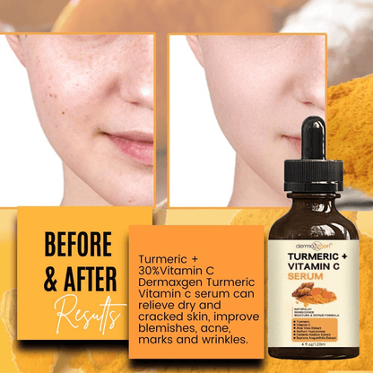 Organic Turmeric Face Serum Dermaxgen Skin Brightening Formula With Pure Vitamin C  Hyaluronic Acid 1