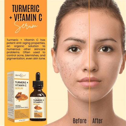 Organic Turmeric Face Serum Dermaxgen Skin Brightening Formula With Pure Vitamin C  Hyaluronic Acid 6