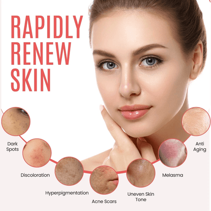 Dark Spot Corrector For Face  Body Organic Sunspot Remover For Hyperpigmentation Age Spots Uneven S 3