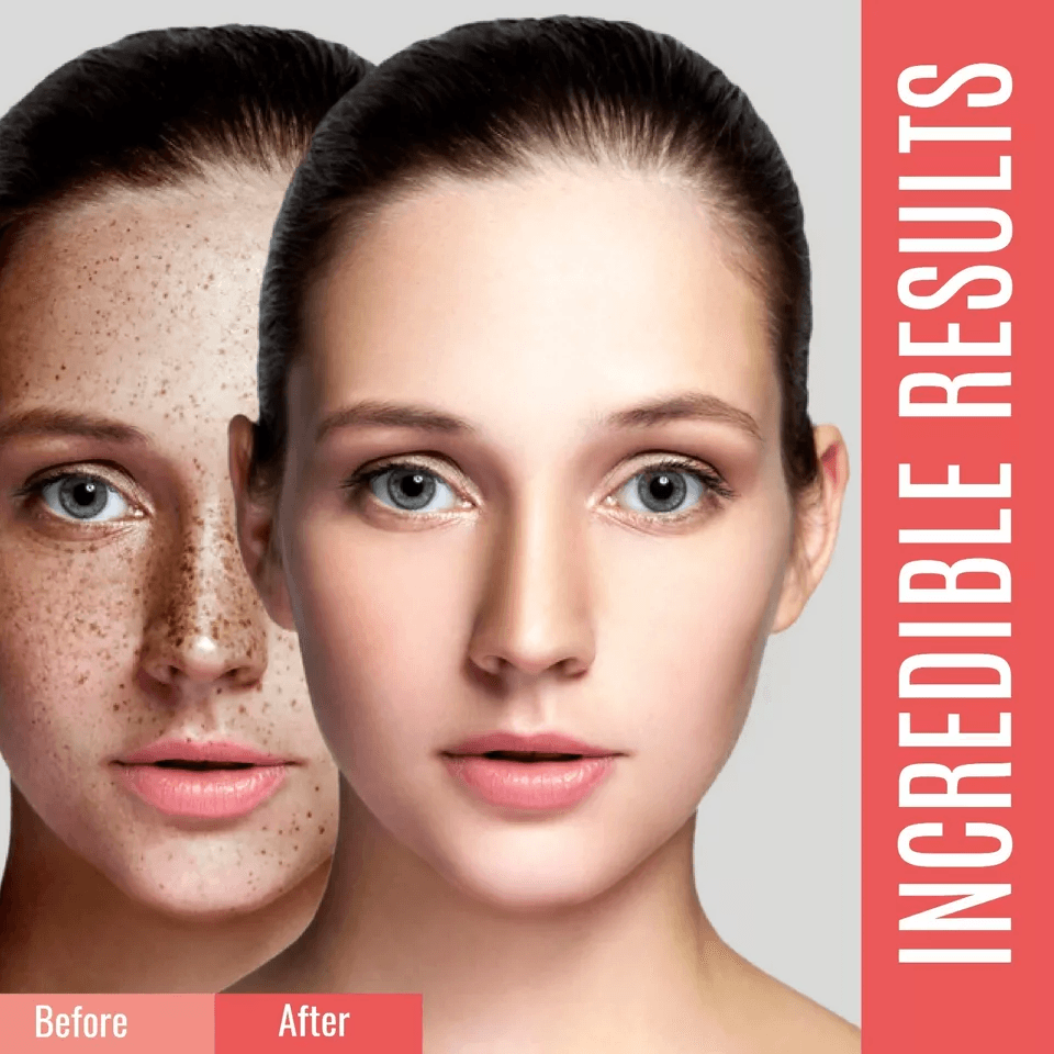 Dark Spot Corrector For Face  Body Organic Sunspot Remover For Hyperpigmentation Age Spots Uneven S 2