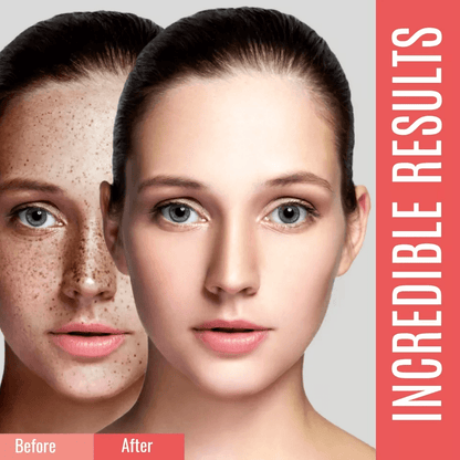 Dark Spot Corrector For Face  Body Organic Sunspot Remover For Hyperpigmentation Age Spots Uneven S 2