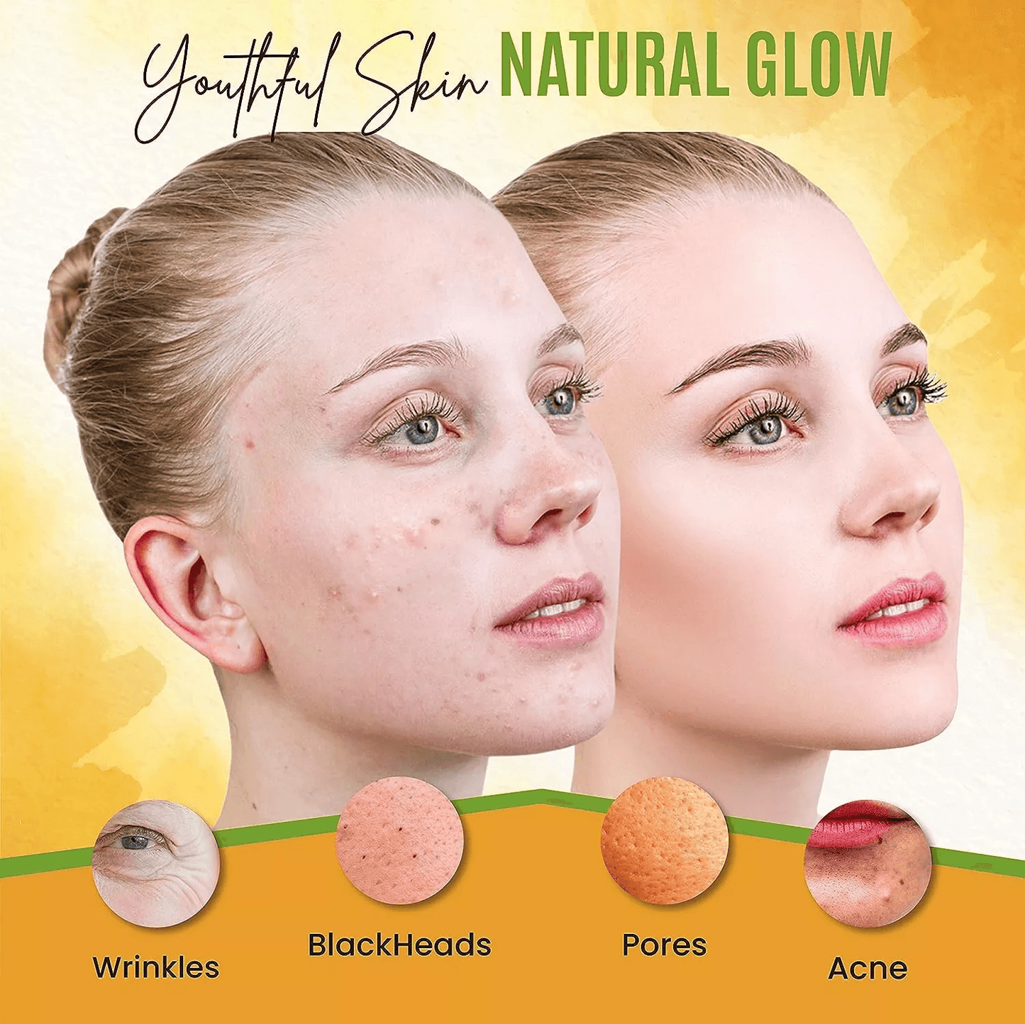 Turmeric Face Mask For Pigmentation Blemish Correction  Dark Spot Removal  Brightens  Heals Skin Na 7
