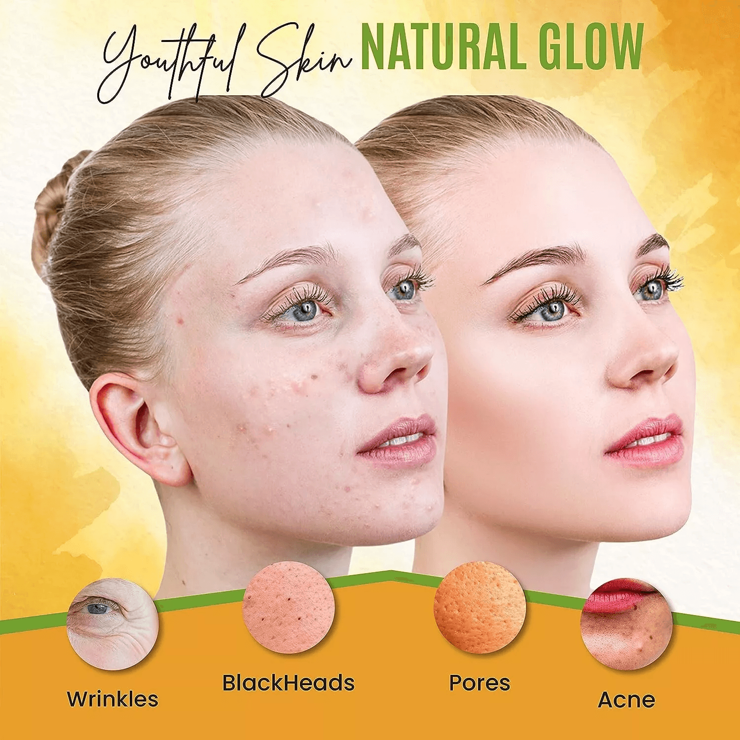 Turmeric Face Mask For Pigmentation Blemish Correction  Dark Spot Removal  Brightens  Heals Skin Na 7