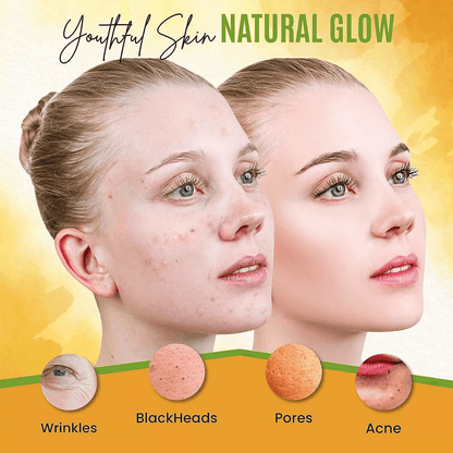 Turmeric Face Mask For Pigmentation Blemish Correction  Dark Spot Removal  Brightens  Heals Skin Na 7