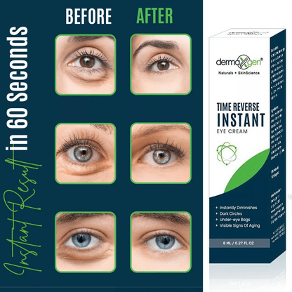 Dermaxgen TIME REVERSE Eye Cream Instant AntiWrinkle Formula To Remove Dark Circles Puffy Eyes  Fin 1