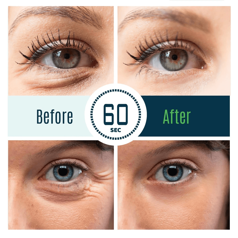 Dermaxgen TIME REVERSE Eye Cream Instant AntiWrinkle Formula To Remove Dark Circles Puffy Eyes  Fin 3