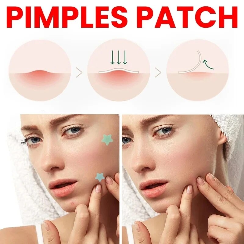 Repair Acne Patch Facial Skin Care Fade Blemishes  Pimple Marks Closed Acne Blemishes Cover 3