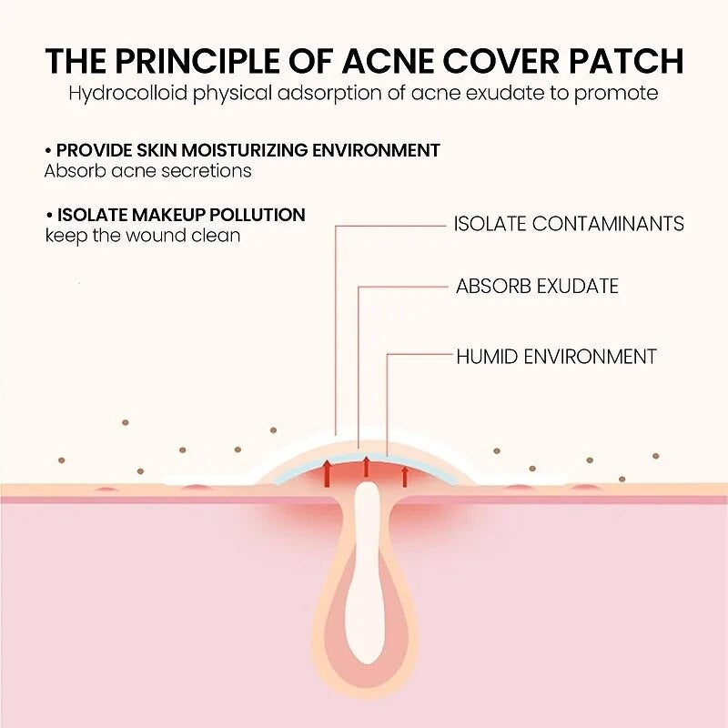 Repair Acne Patch Facial Skin Care Fade Blemishes  Pimple Marks Closed Acne Blemishes Cover 4