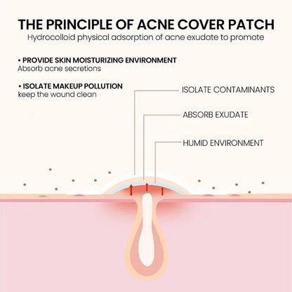 Repair Acne Patch Facial Skin Care Fade Blemishes  Pimple Marks Closed Acne Blemishes Cover 4